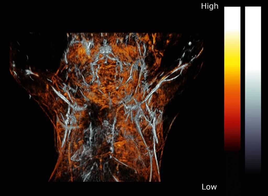 Photoacoustic image of the upper torso and brain of a female mouse.