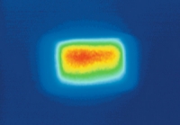 308nm Excimer Profile